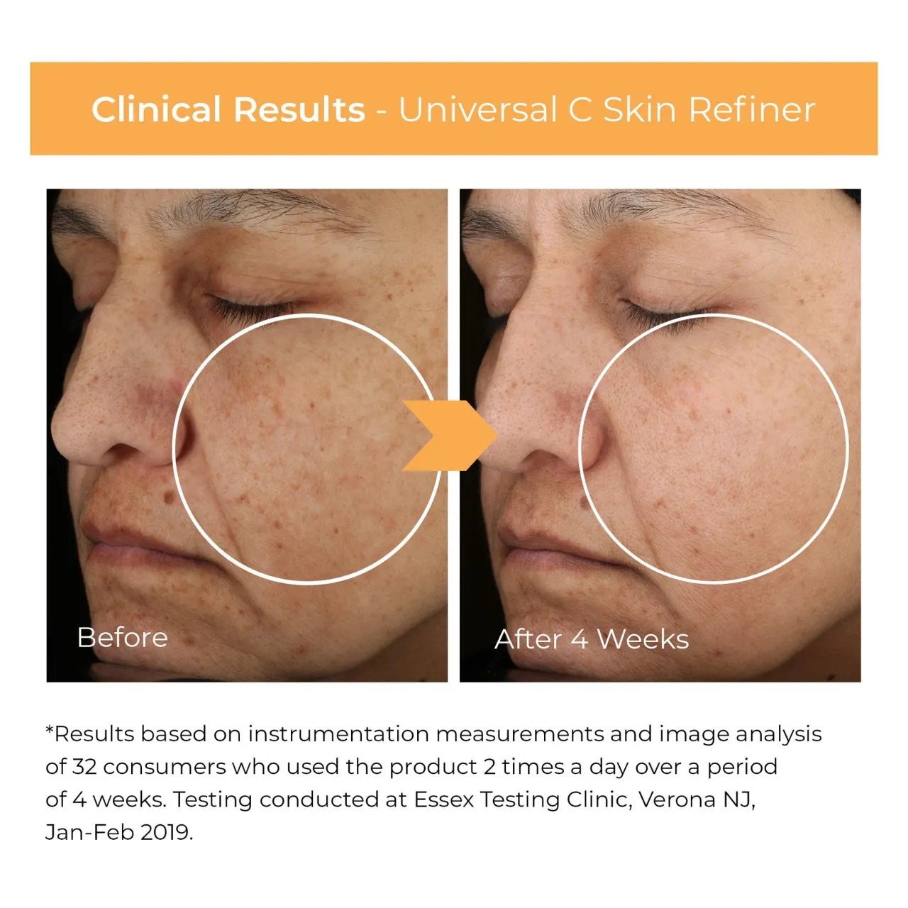 Universal C Skin Refiner